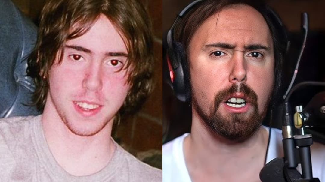Asmongold revela por qué se parece a una rata y urge a sus espectadores a cepillarse los dientes