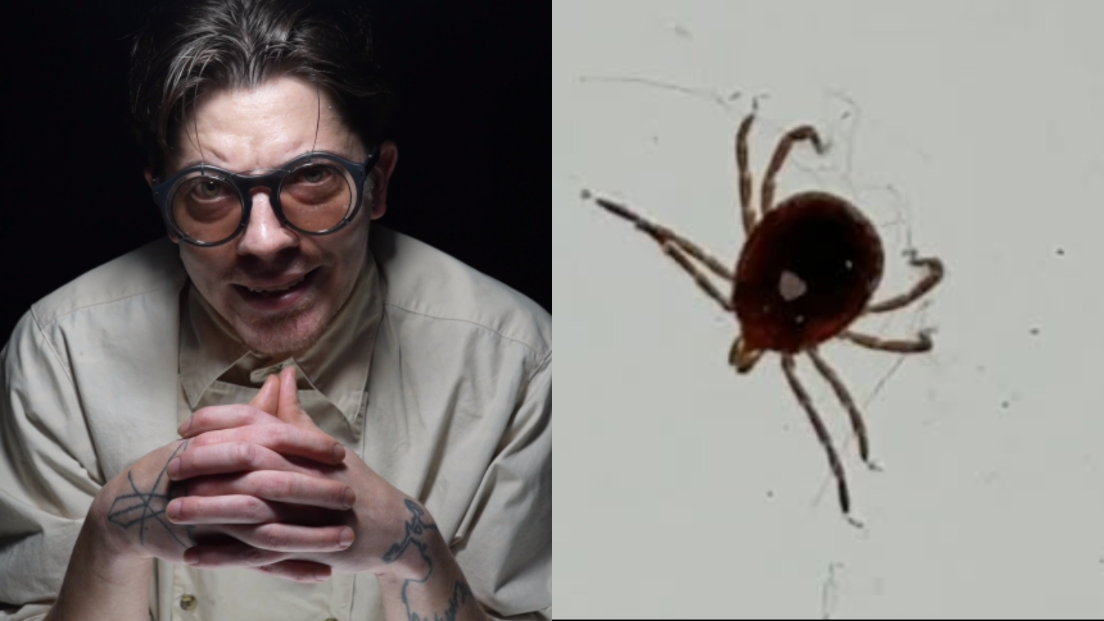 YouTuber Rusty Cage spends days trying to kill tick found in body by freezing y drowning it